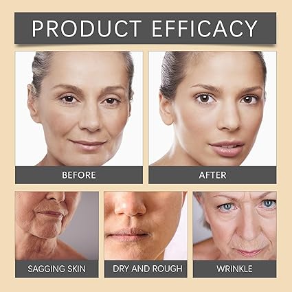OUHOE Bee Venom Peptide Anti-Wrinkle Cream (20g) | Natural Botox Effect Face Lift & Collagen Booster