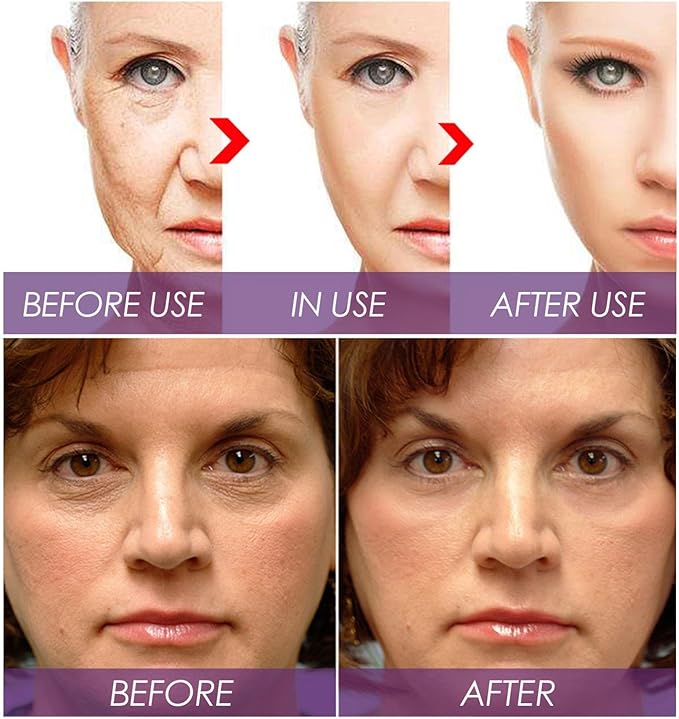Comparison of skin improvements with Venature Bakuchiol Retinol Rejuvenation Serum showing before, during, and after use on mature and sensitive skin.
