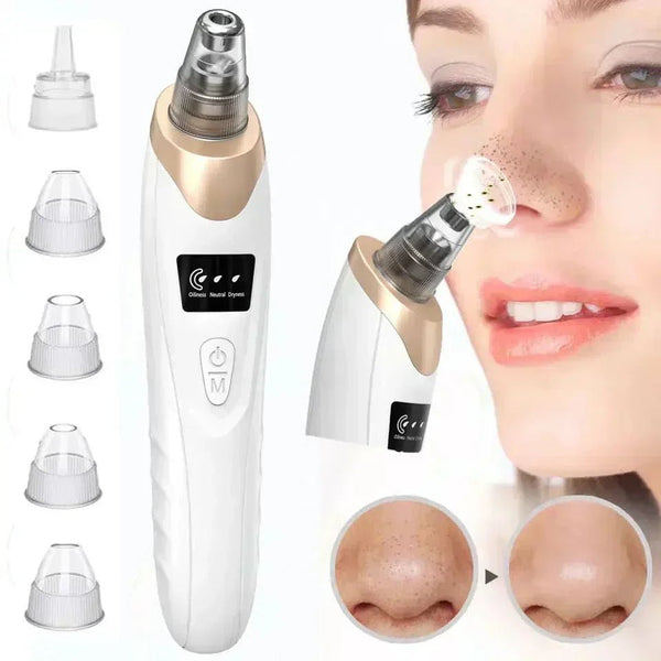 5-in-1 Vacuum Blackhead Remover & Pore Cleaner | UAE